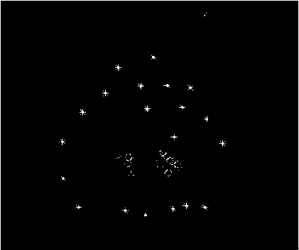 Support vector machine-based ultrasonic image segmentation method