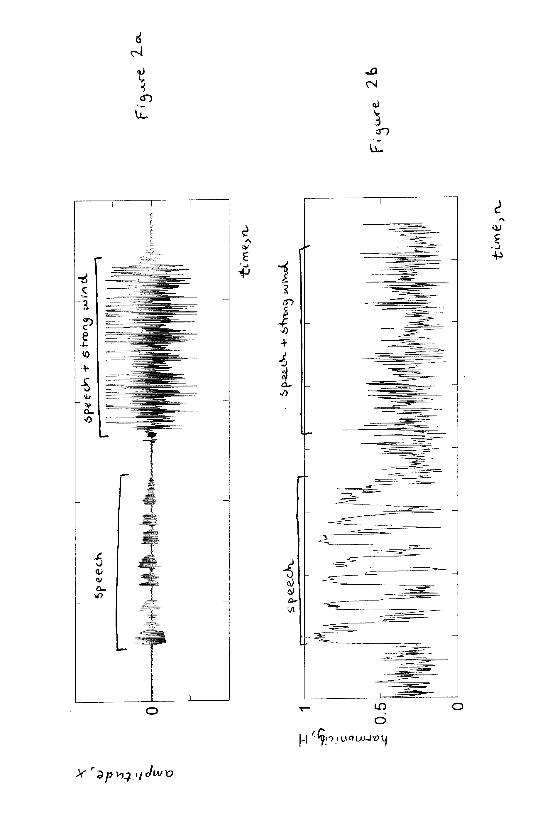 Wind Noise Suppression