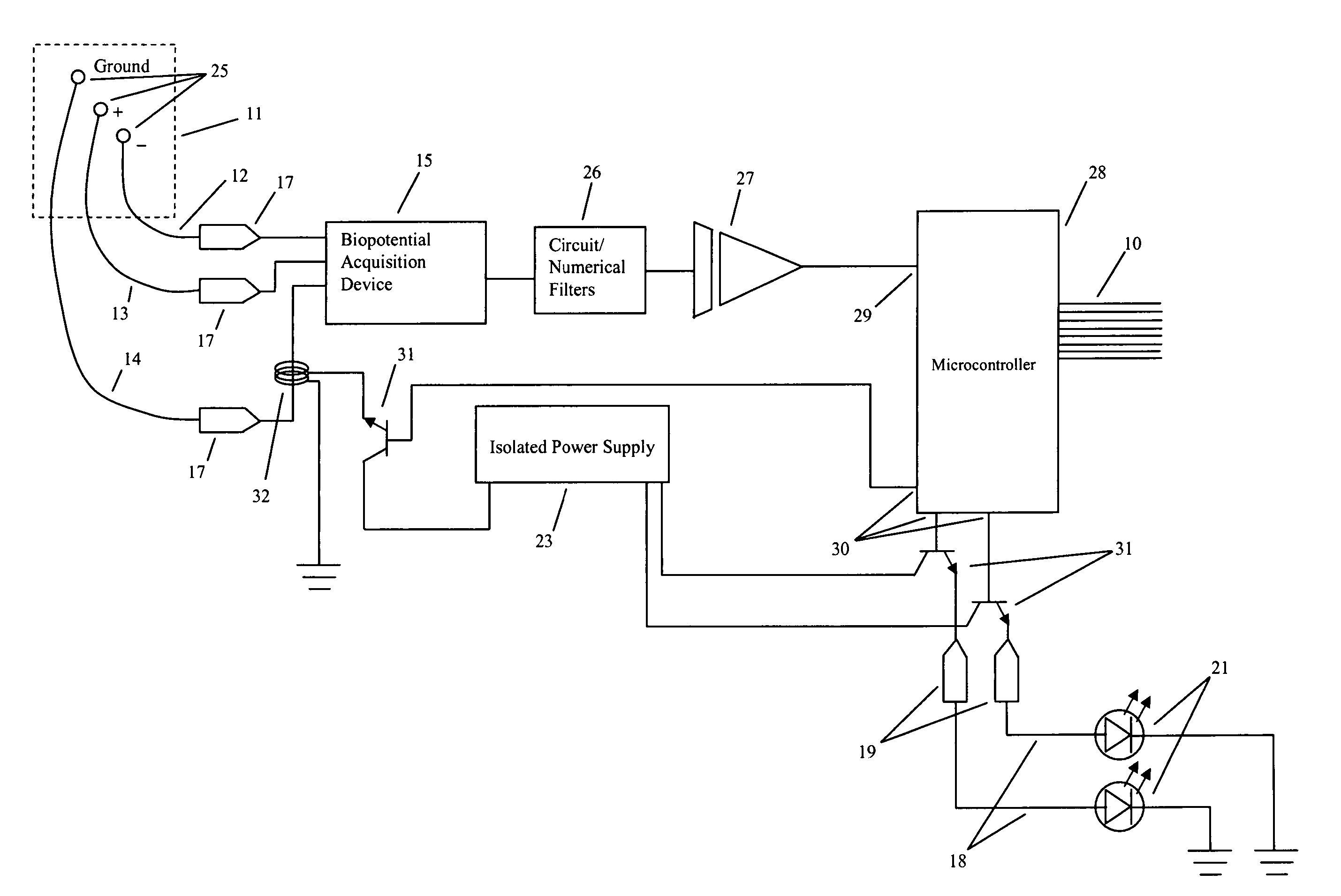 Method and apparatus for utilizing amplitude-modulated pulse-width modulation signals for neurostimulation and treatment of neurological disorders using electrical stimulation