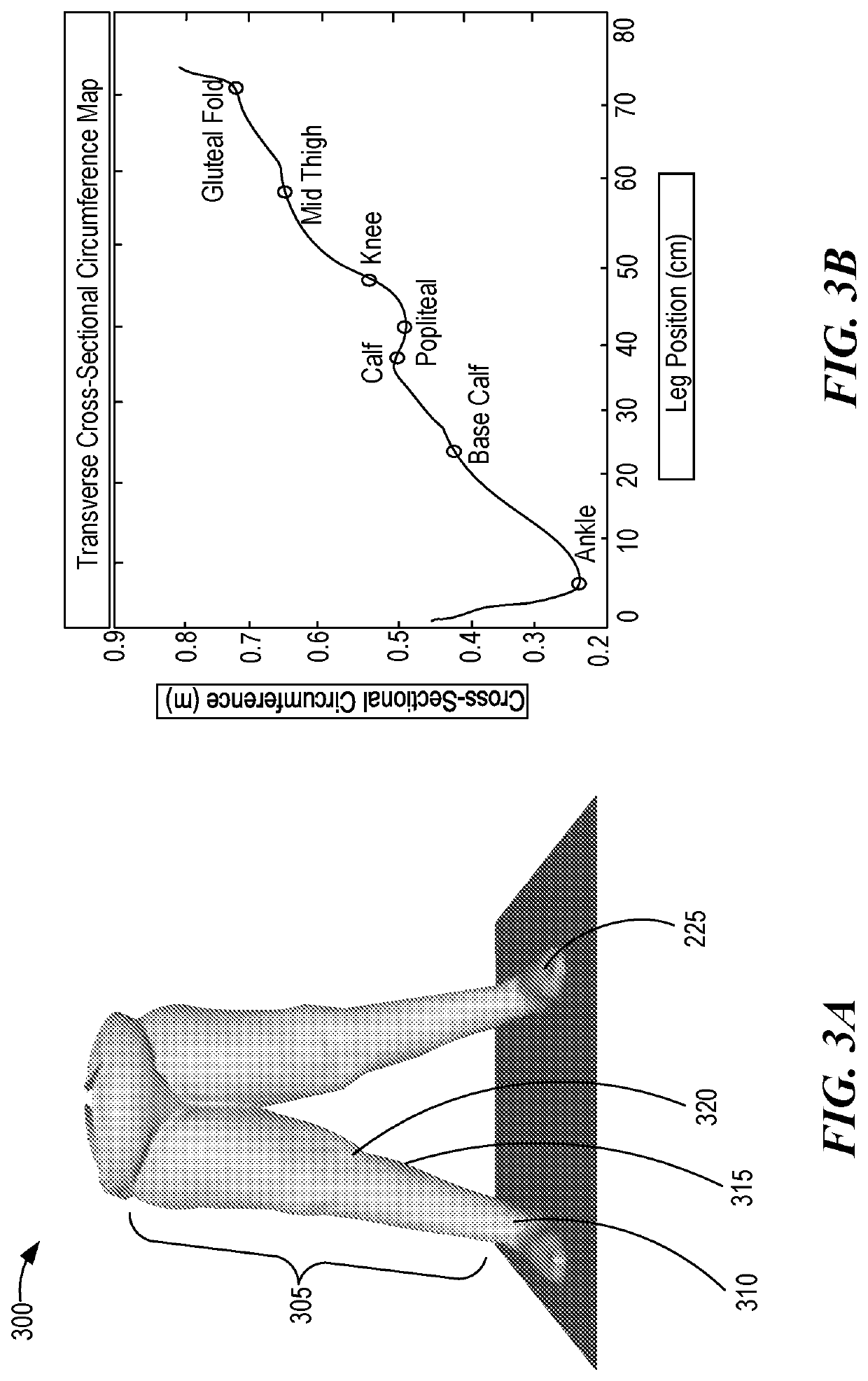 Identifying body part or body area anatomical landmarks from digital imagery for the fitting of compression garments for a person in need thereof