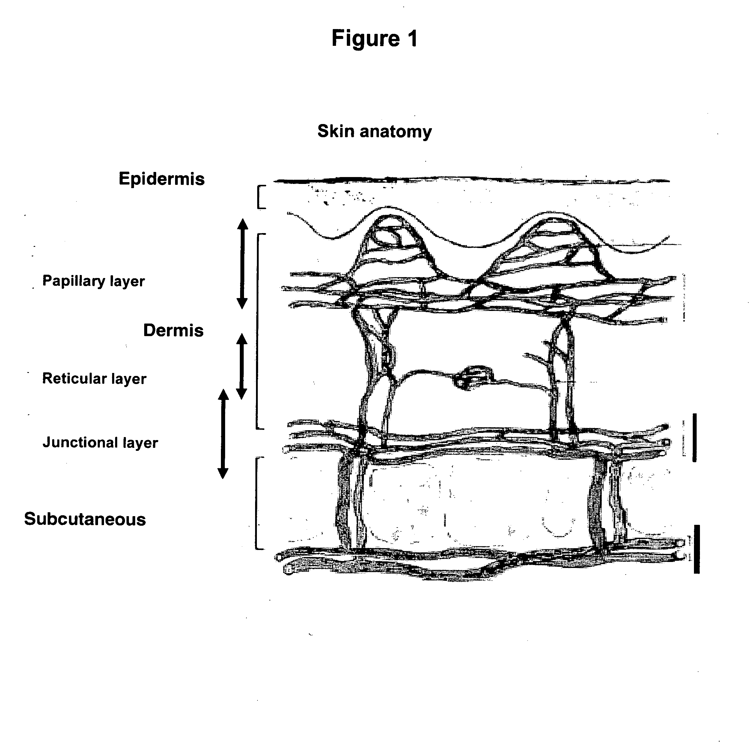 Novel methods for administration of drugs and devices useful thereof