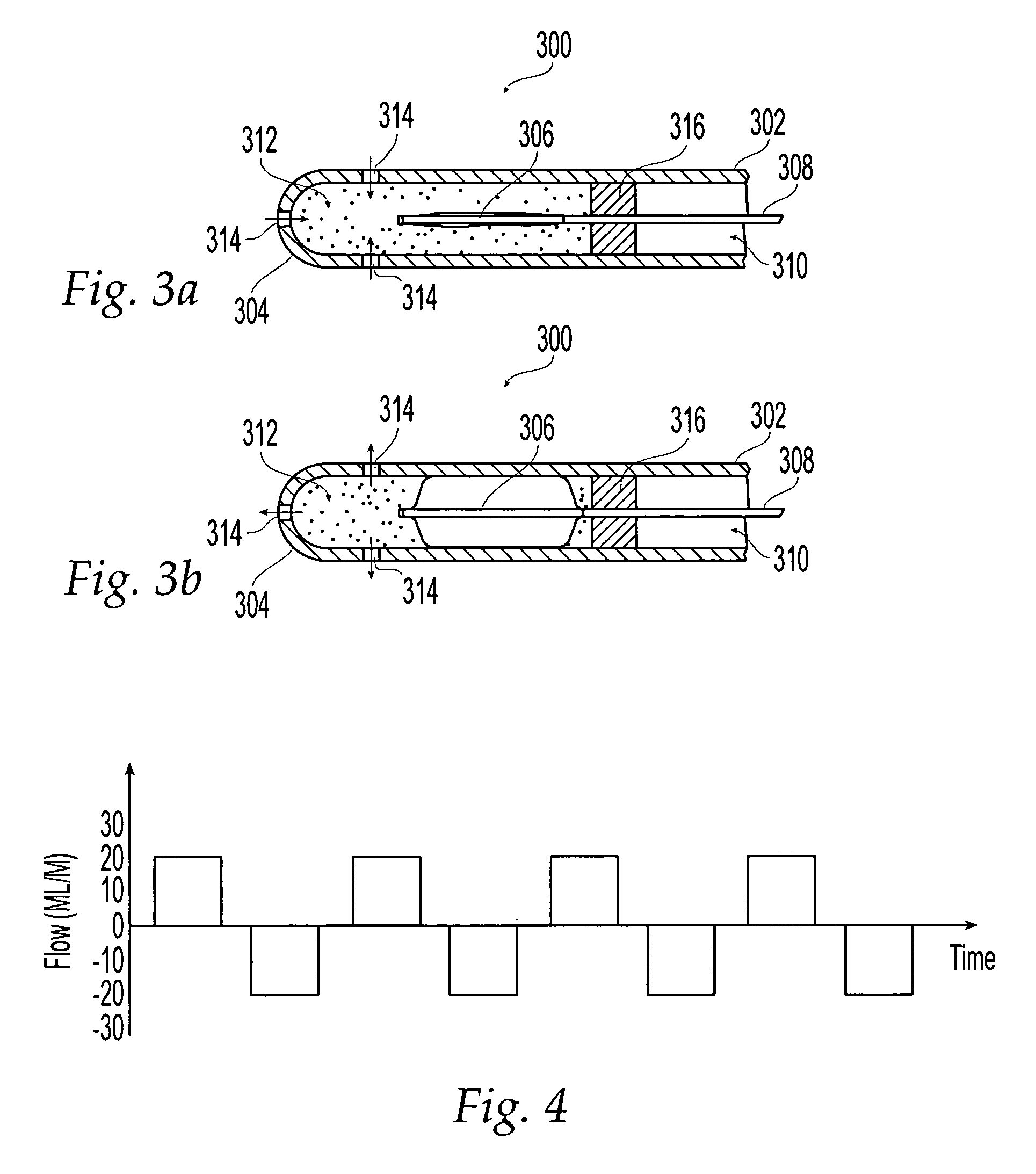 Cooled ablation catheter with reciprocating flow