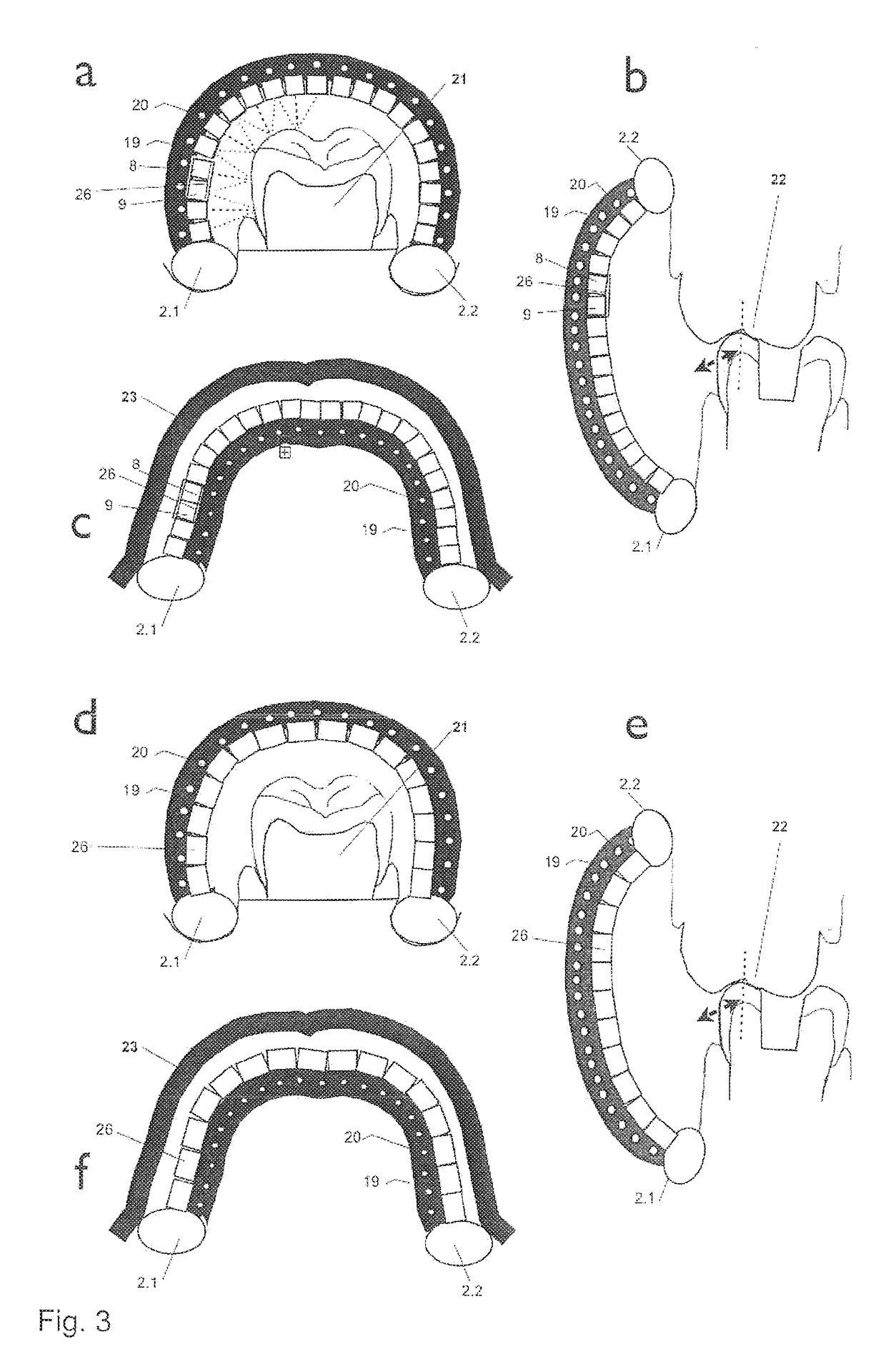 Measuring apparatus and method for three-dimensional measurement of an oral cavity