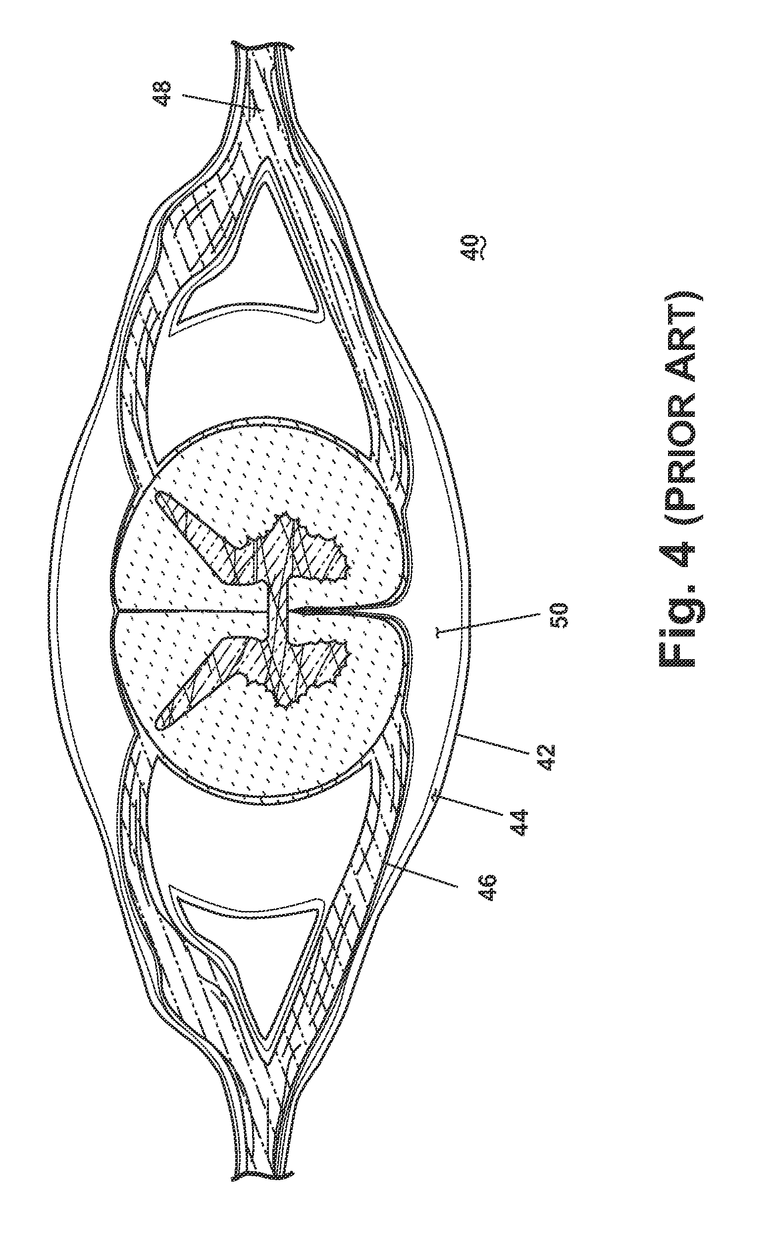 Composition and methods of treatment of bacterial meningitis