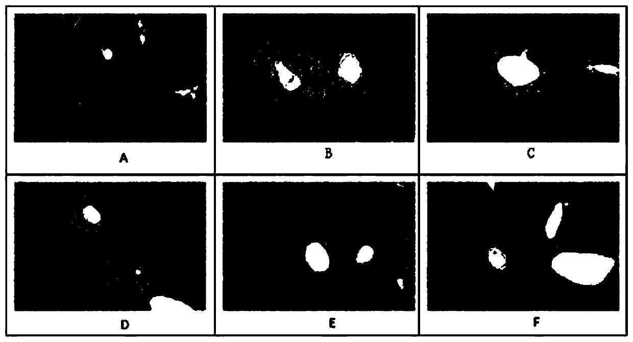 Traditional Chinese medicine composition for preventing and treating drug-induced liver injury, and preparation method and application thereof