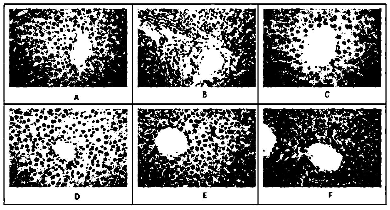 Traditional Chinese medicine composition for preventing and treating drug-induced liver injury, and preparation method and application thereof