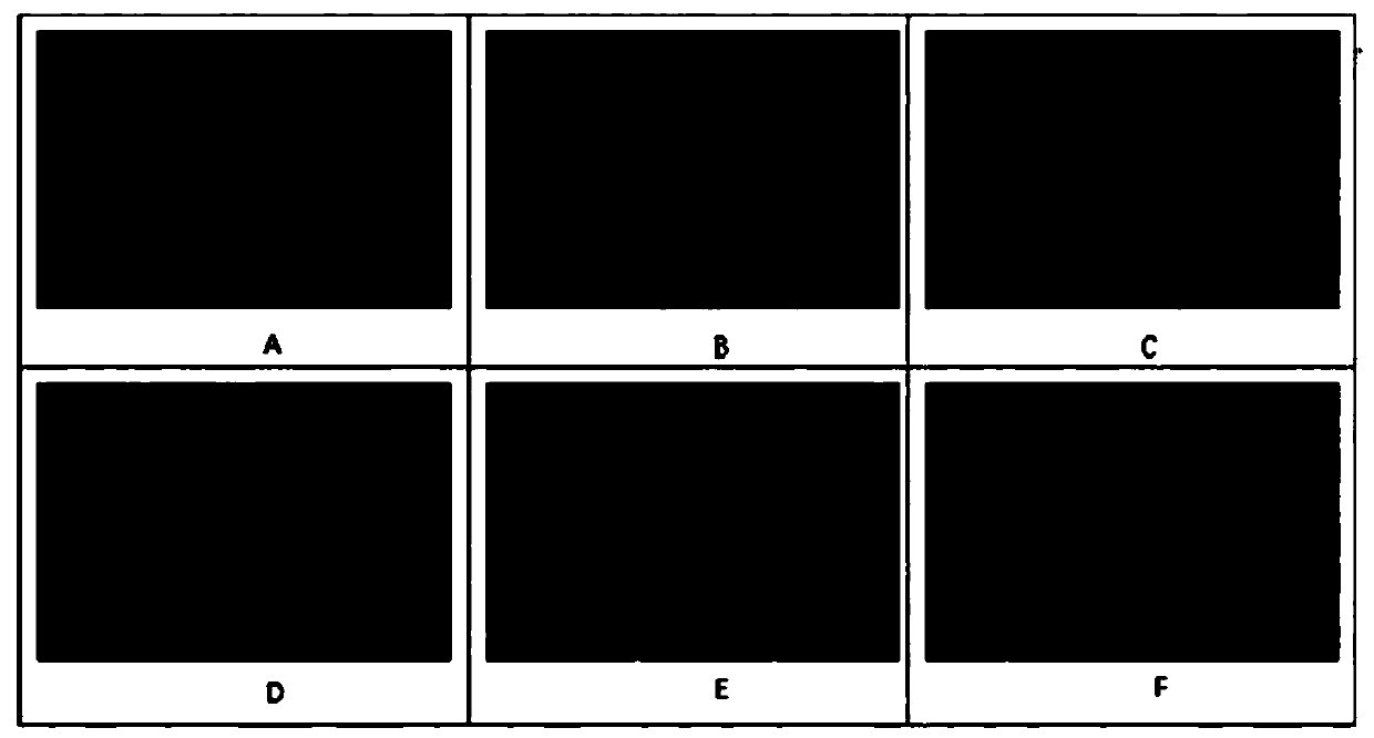 Traditional Chinese medicine composition for preventing and treating drug-induced liver injury, and preparation method and application thereof