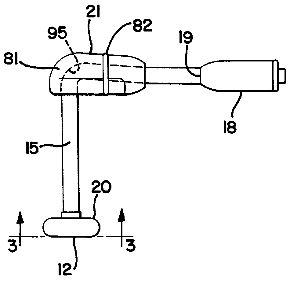 Retention balloon for a corporeal access tube assembly