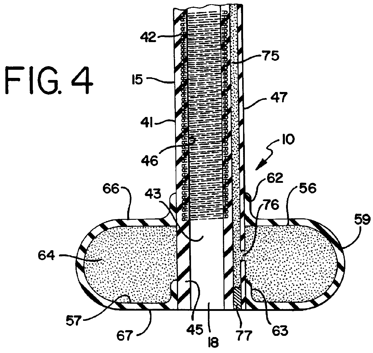 Retention balloon for a corporeal access tube assembly