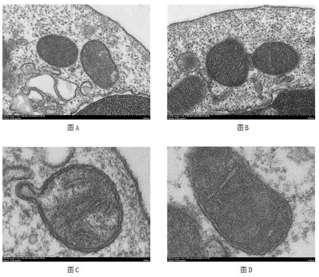 Application of atpif1 gene silenced T cells in preparation of antitumor drugs