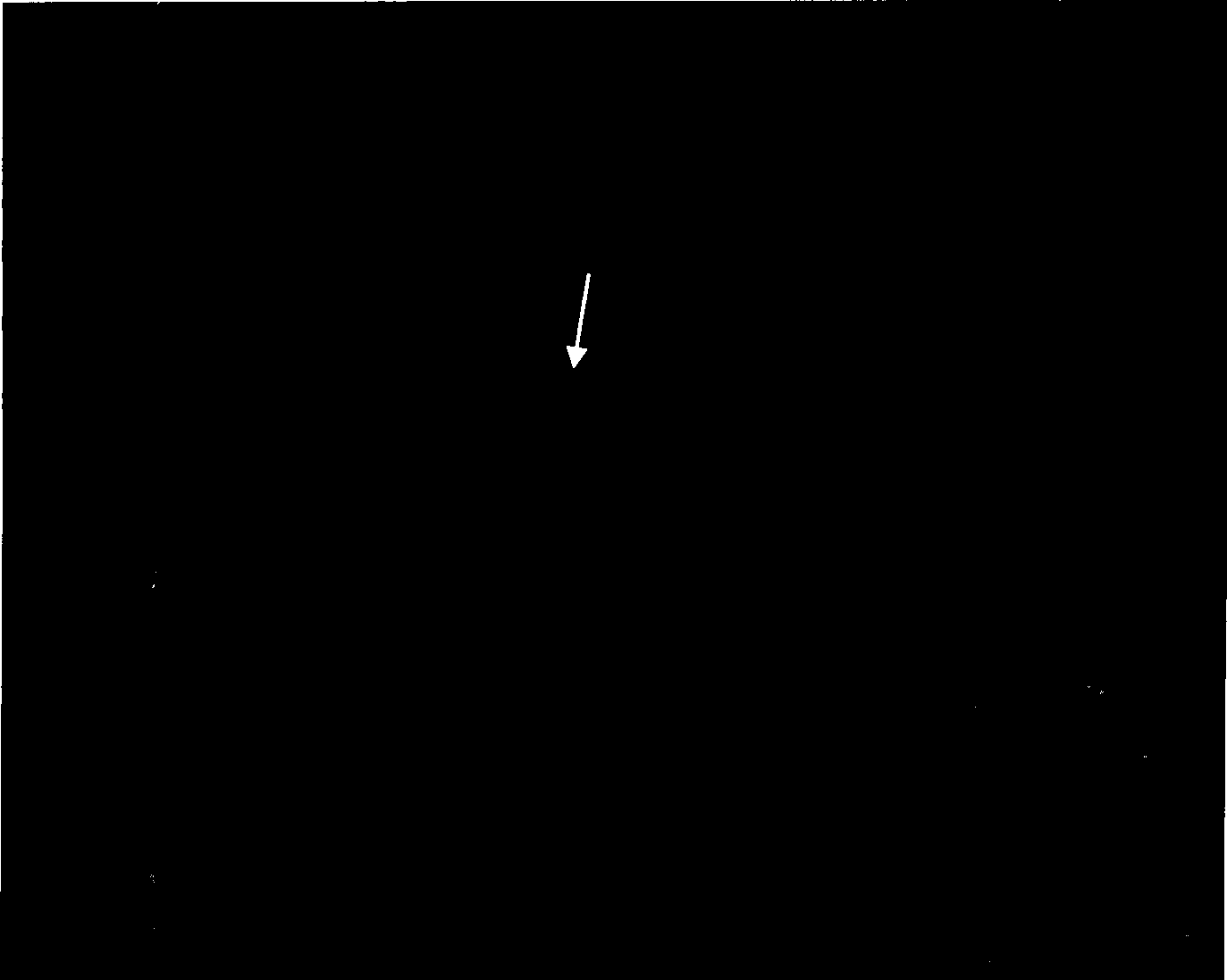 Perultimate chromomere marker of cotton chromosome fluorescent in situ hybridization and use thereof