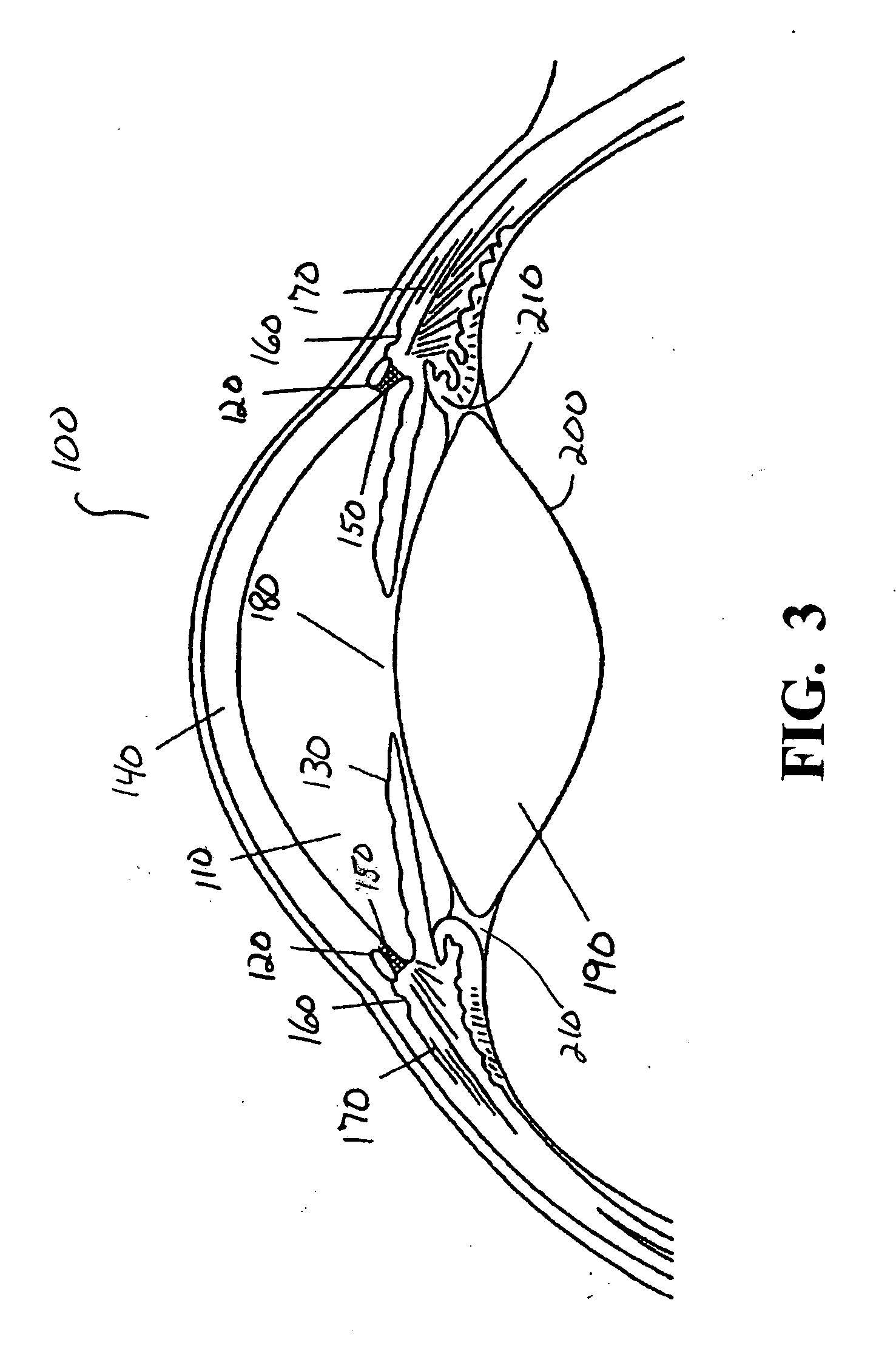 Surgical method