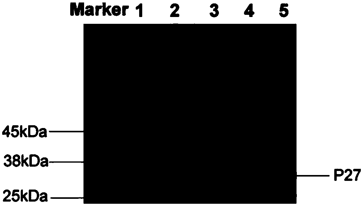 Colloidal gold detection kit for detecting avian leukosis virus and application thereof