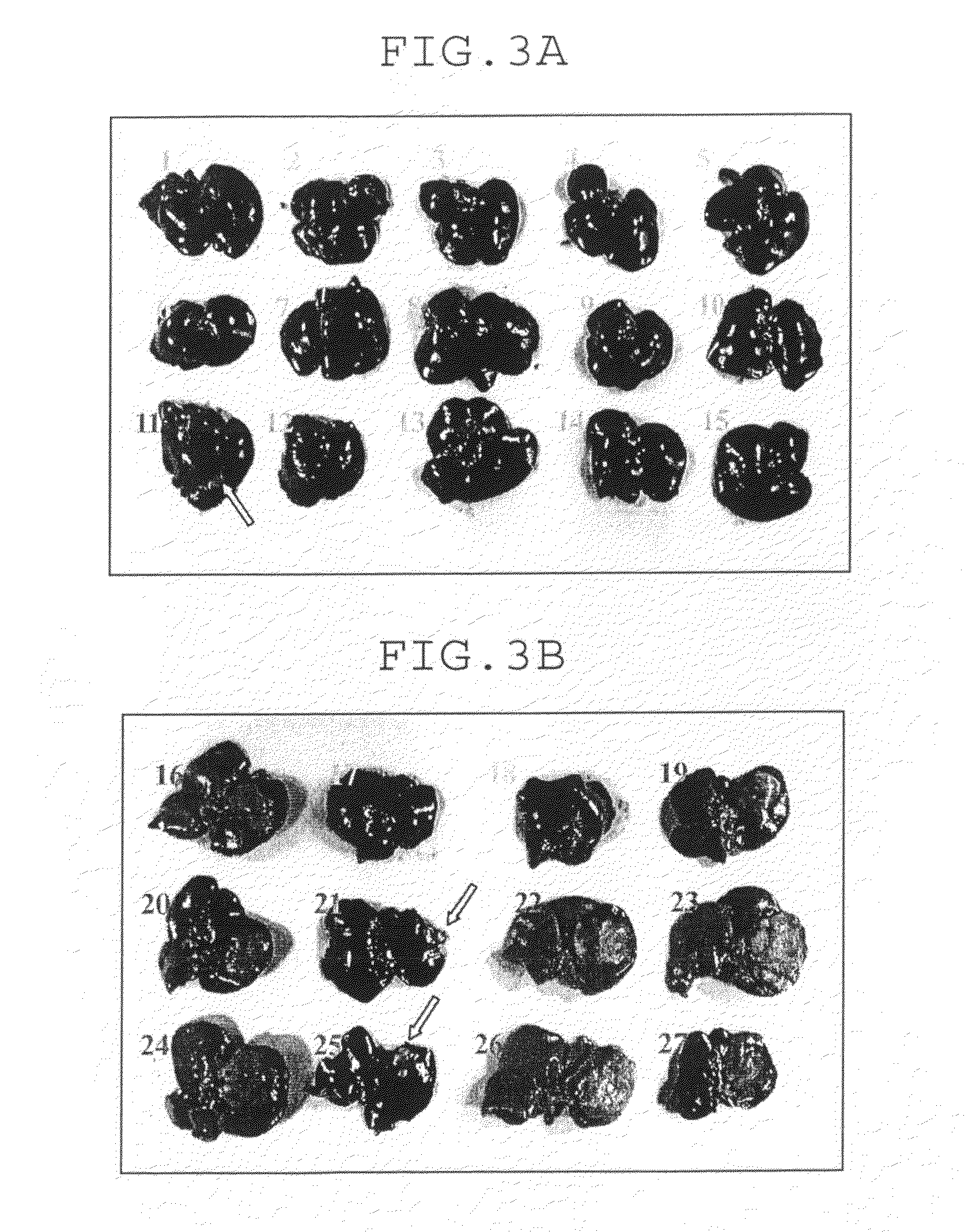 Amebiasis vaccine