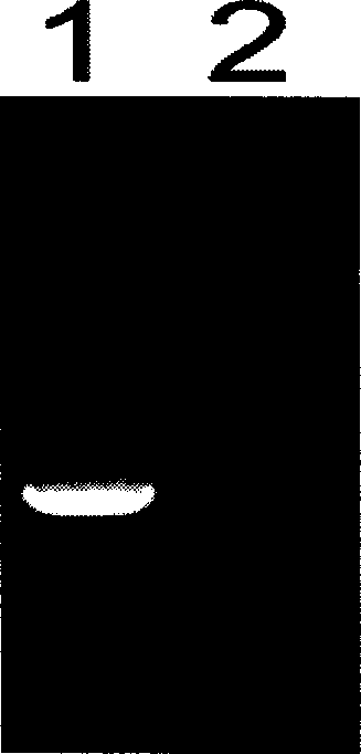 Novel use of thymosin alpha protogene