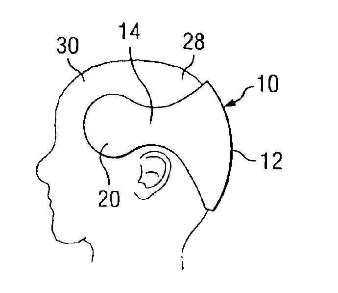 Cranial orthosis for preventing positional plagiocephaly in infants