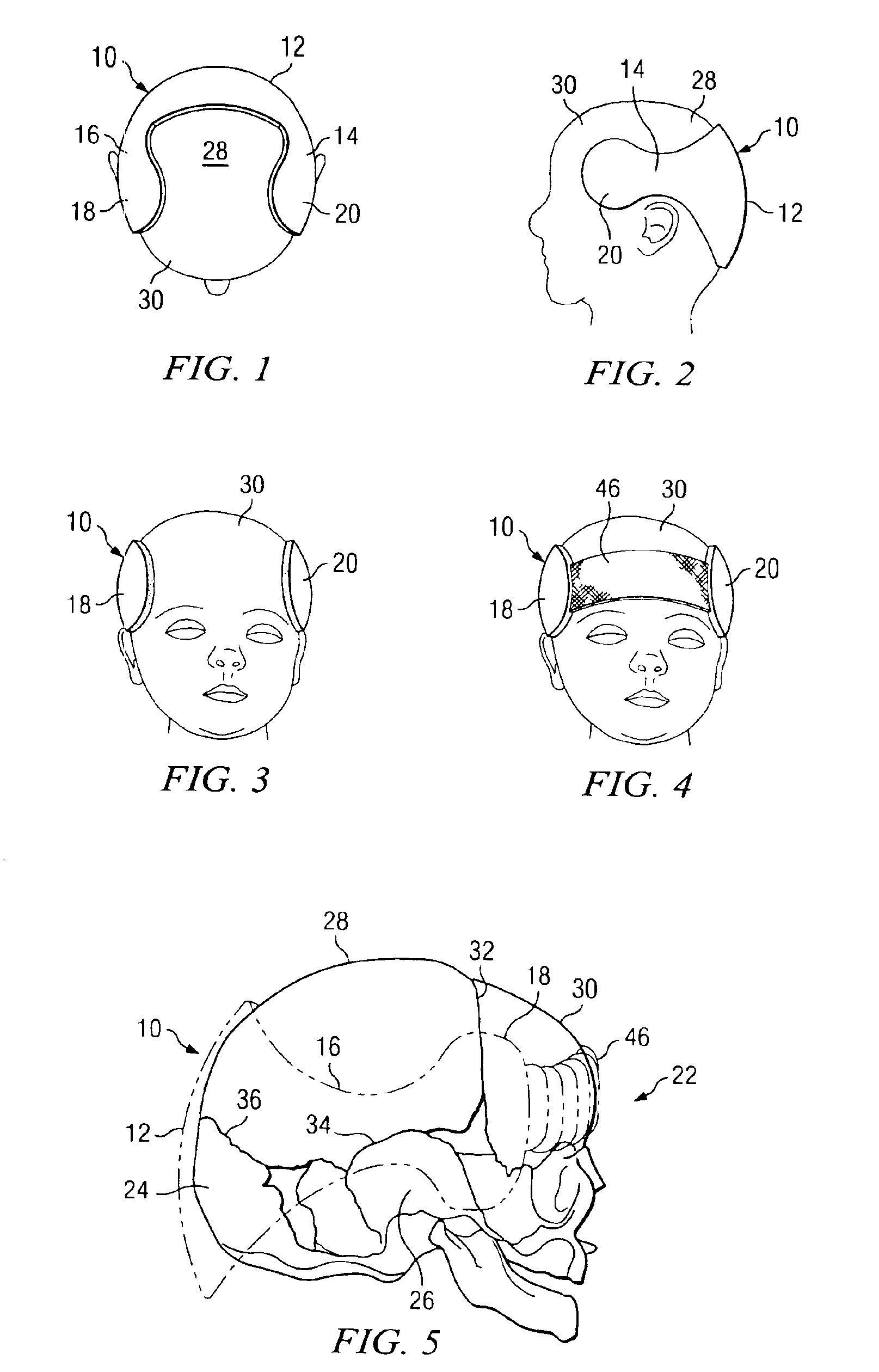 Cranial orthosis for preventing positional plagiocephaly in infants