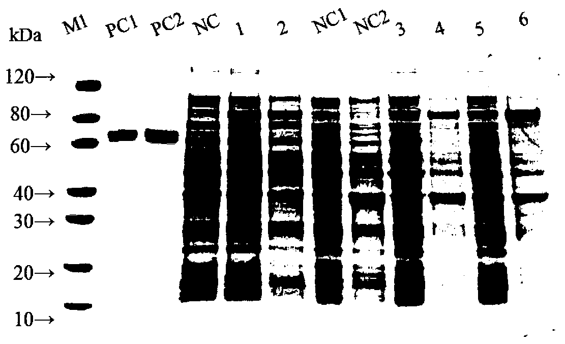 Clostridium perfringens beta toxin recombinant subunit vaccine and production method thereof