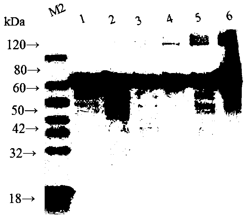 Clostridium perfringens beta toxin recombinant subunit vaccine and production method thereof