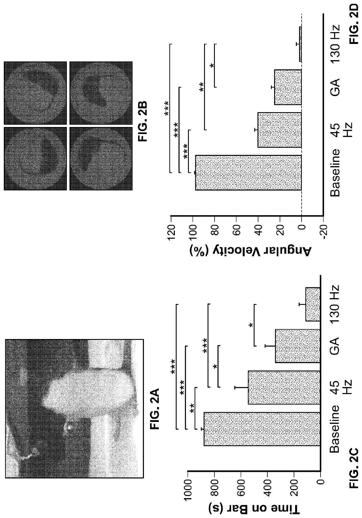 Method to design temporal patterns of nervous system stimulation