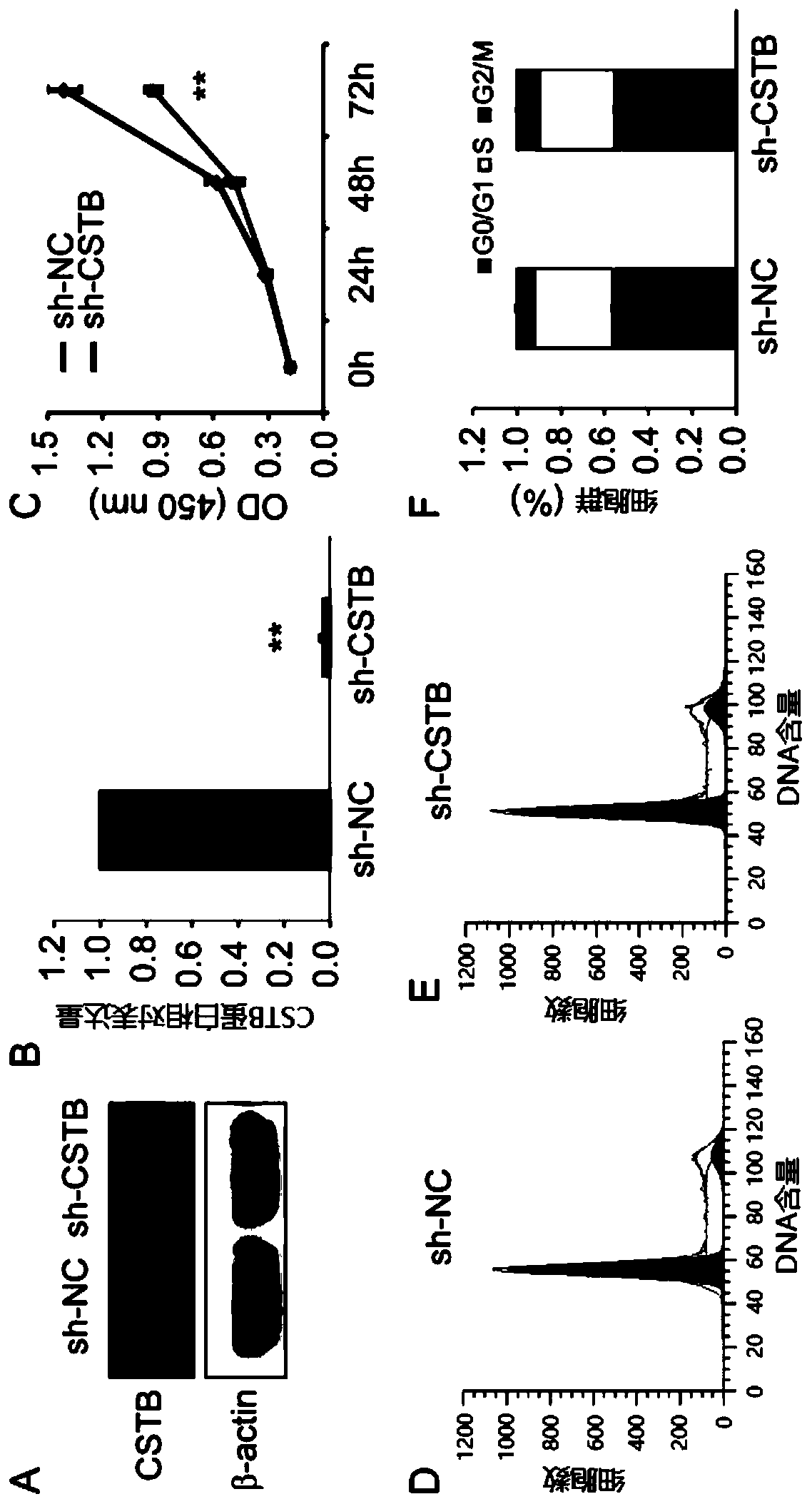 SiRNA molecule against human cysteine proteinase inhibitor B (CSTB) and application thereof