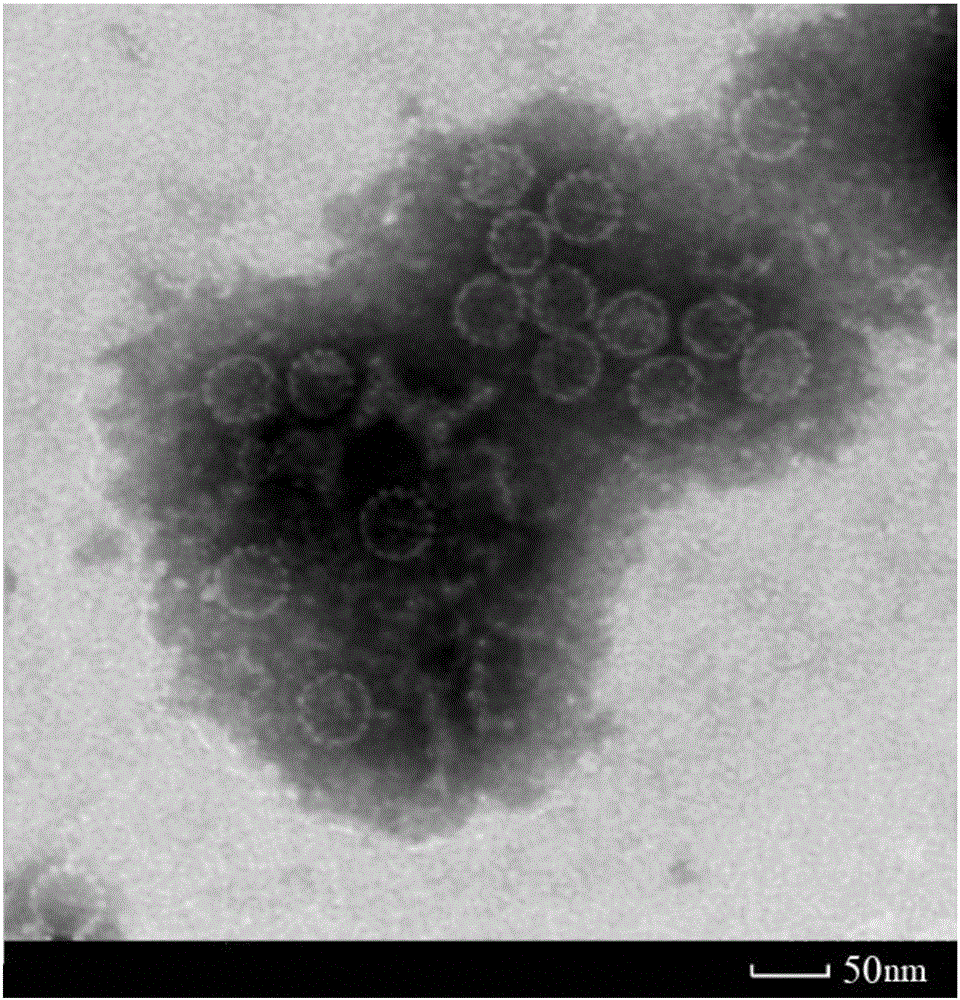 Method for preparing human papilloma virus (HPV) L1 protein virus-like particles (VLP)