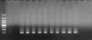 Method and kit for rapidly extracting DNA of soil