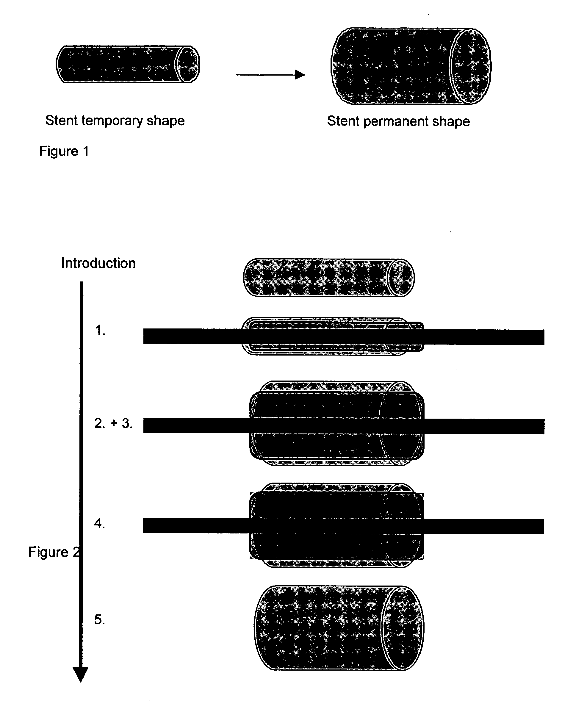 Biodegradable stents