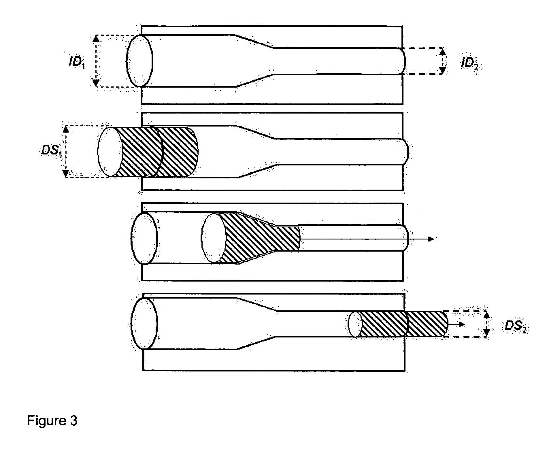 Biodegradable stents