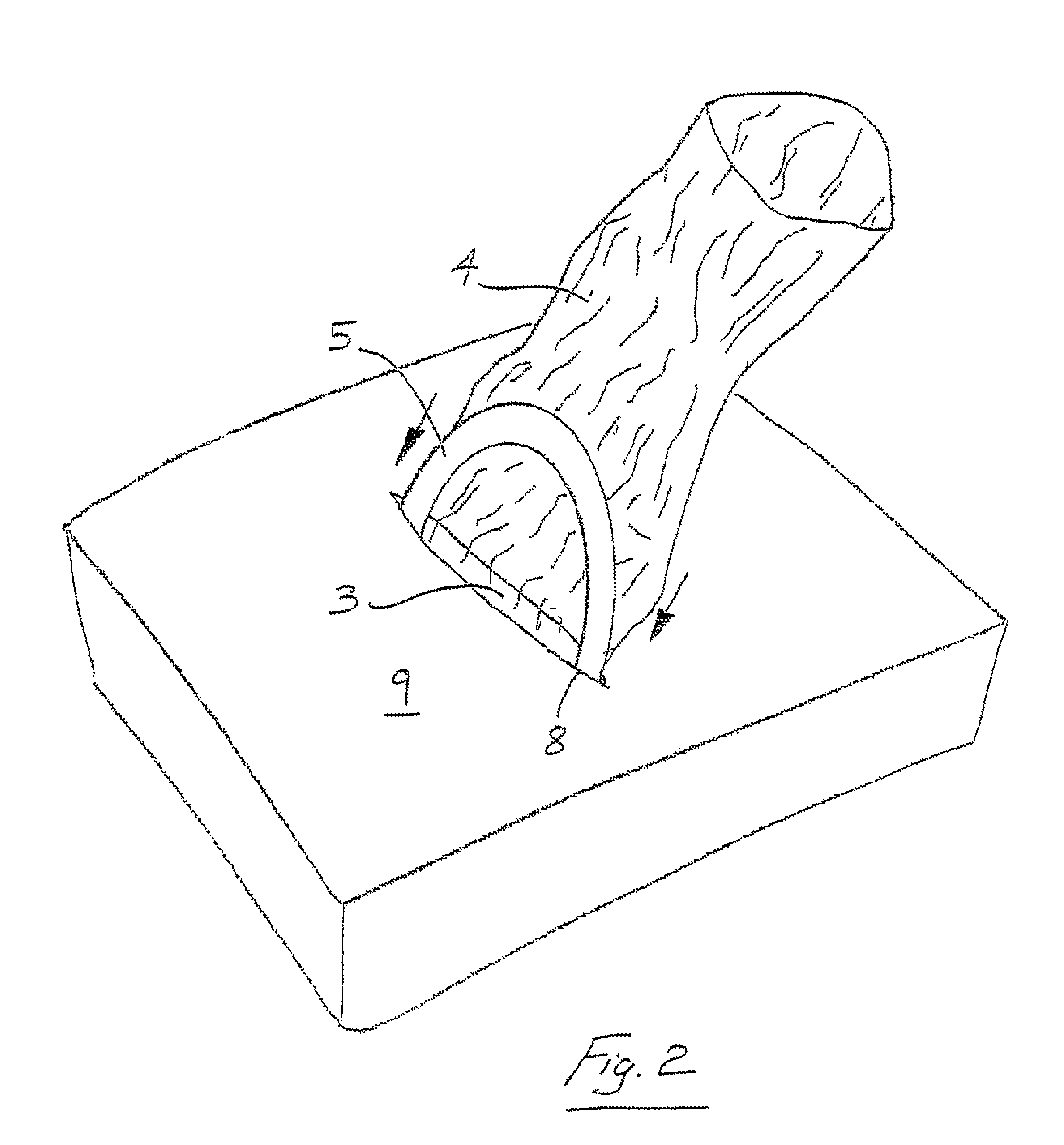 Wound retractor system