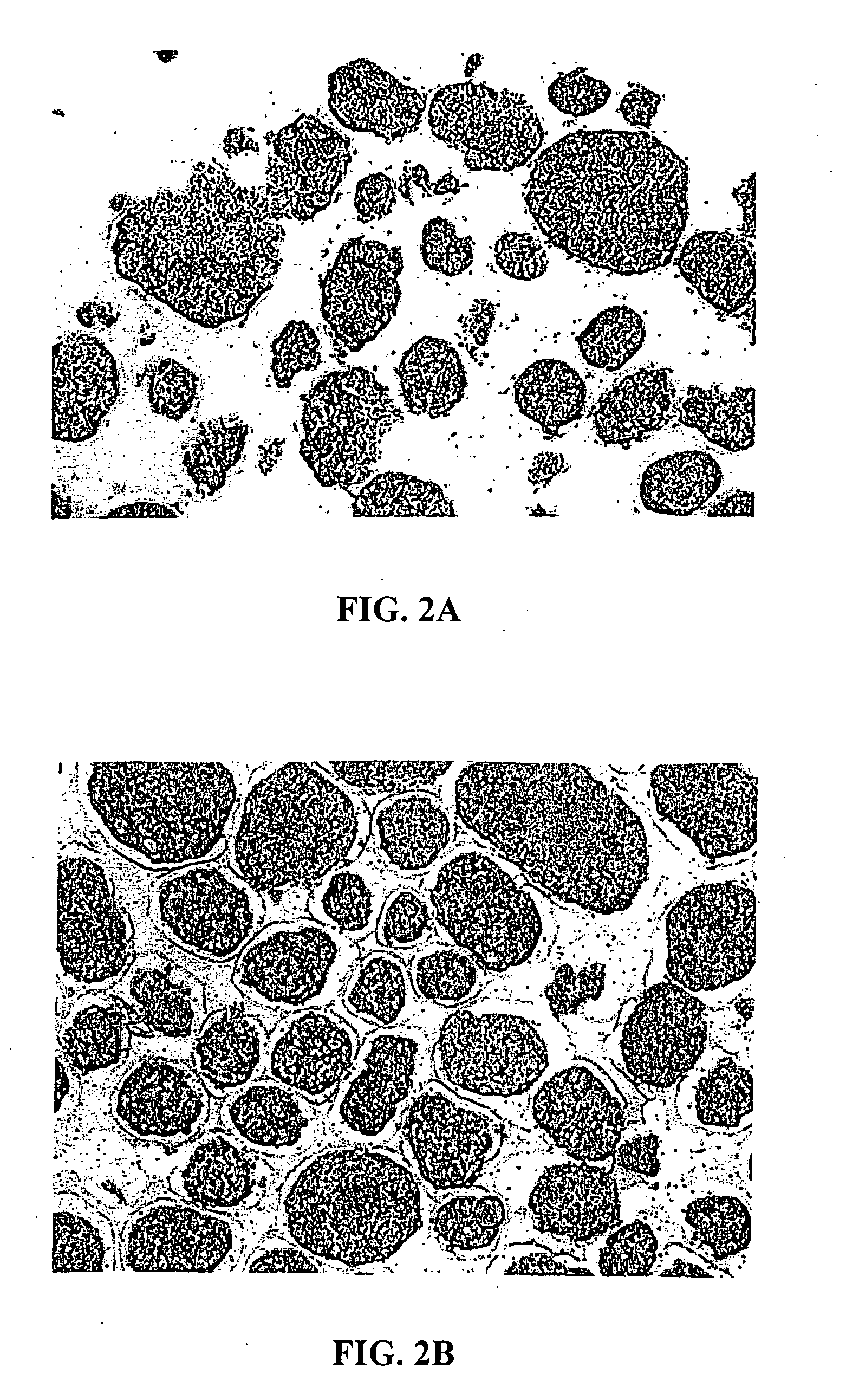 Inhibition of pancreatic islet aggregation