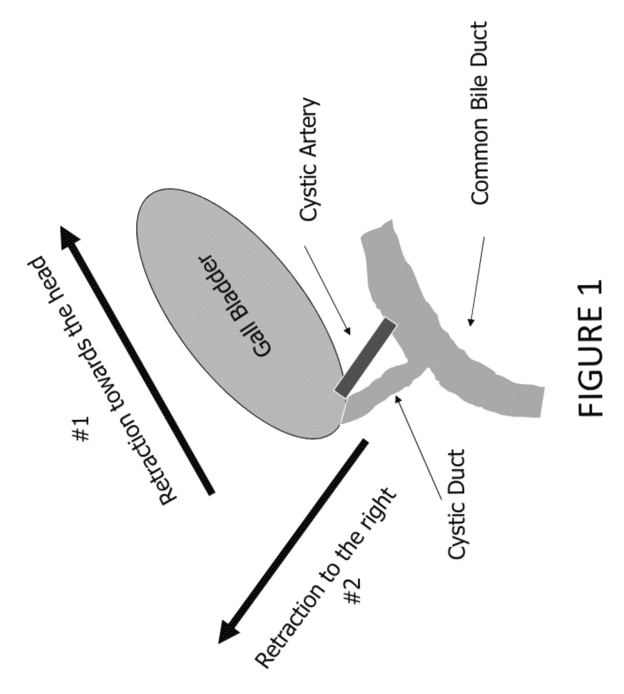 Laparoscopic retractor