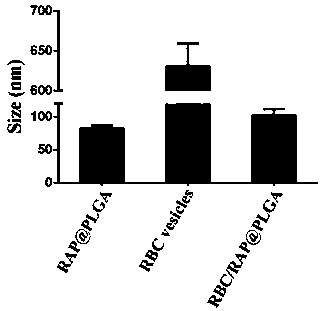 Erythrocyte membrane-encapsulated rapamycin nanoparticle and preparation method and application thereof