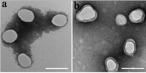 Erythrocyte membrane-encapsulated rapamycin nanoparticle and preparation method and application thereof