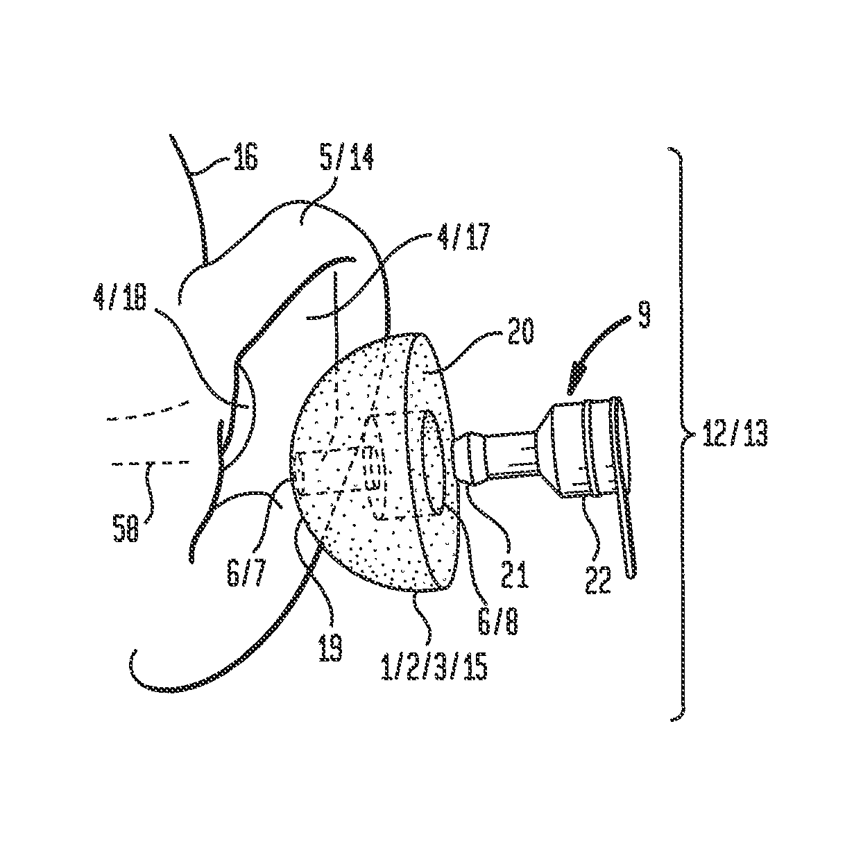 Moldable earpiece system