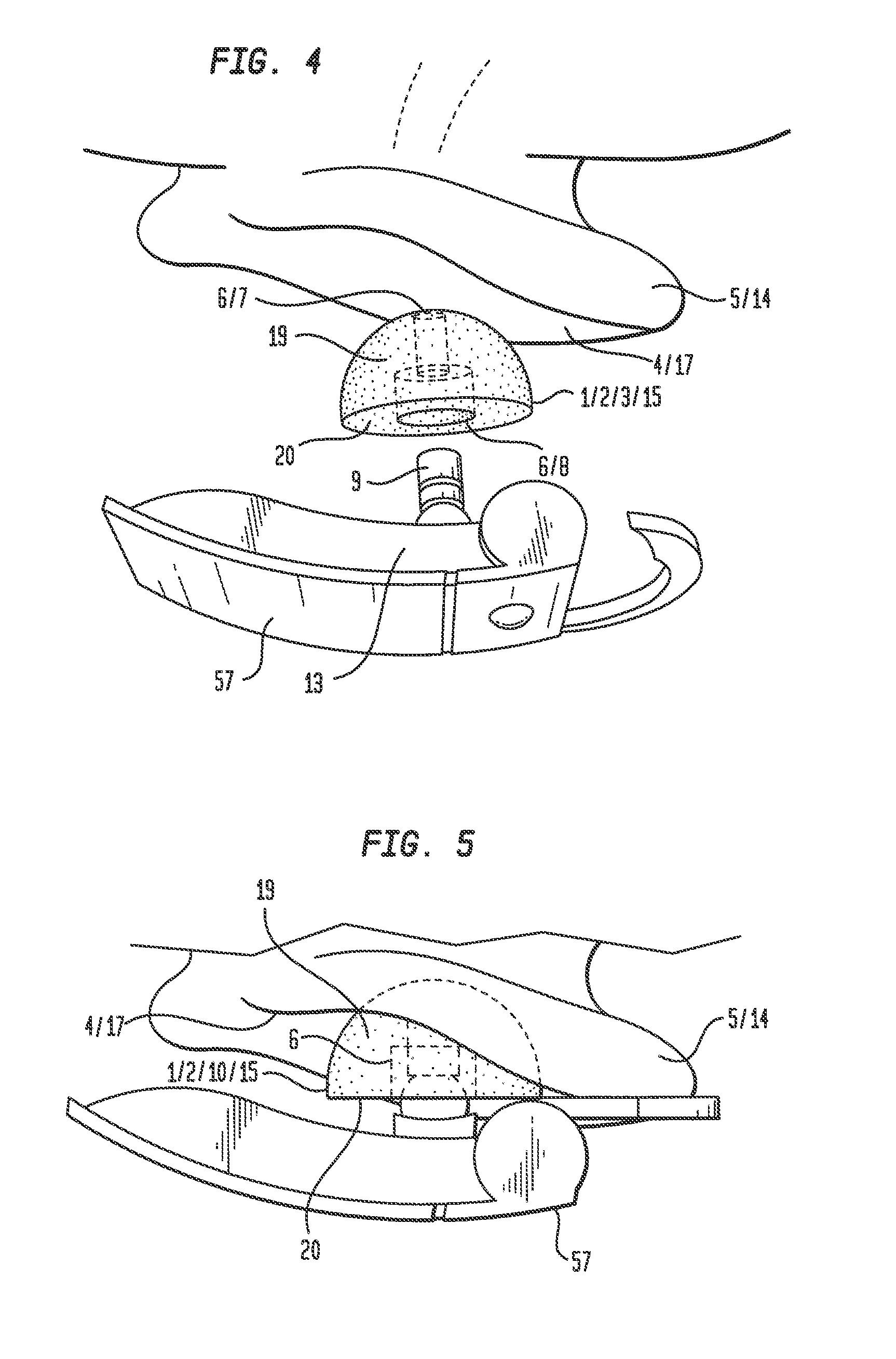 Moldable earpiece system