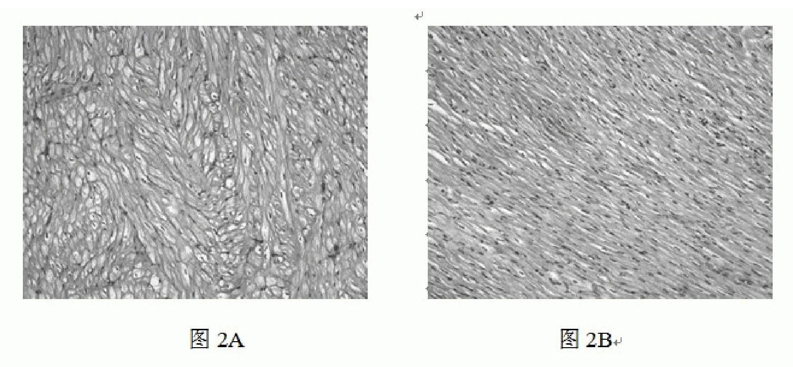 Method for preparing animal model with cardiac hypertrophy by unartificial ventilation