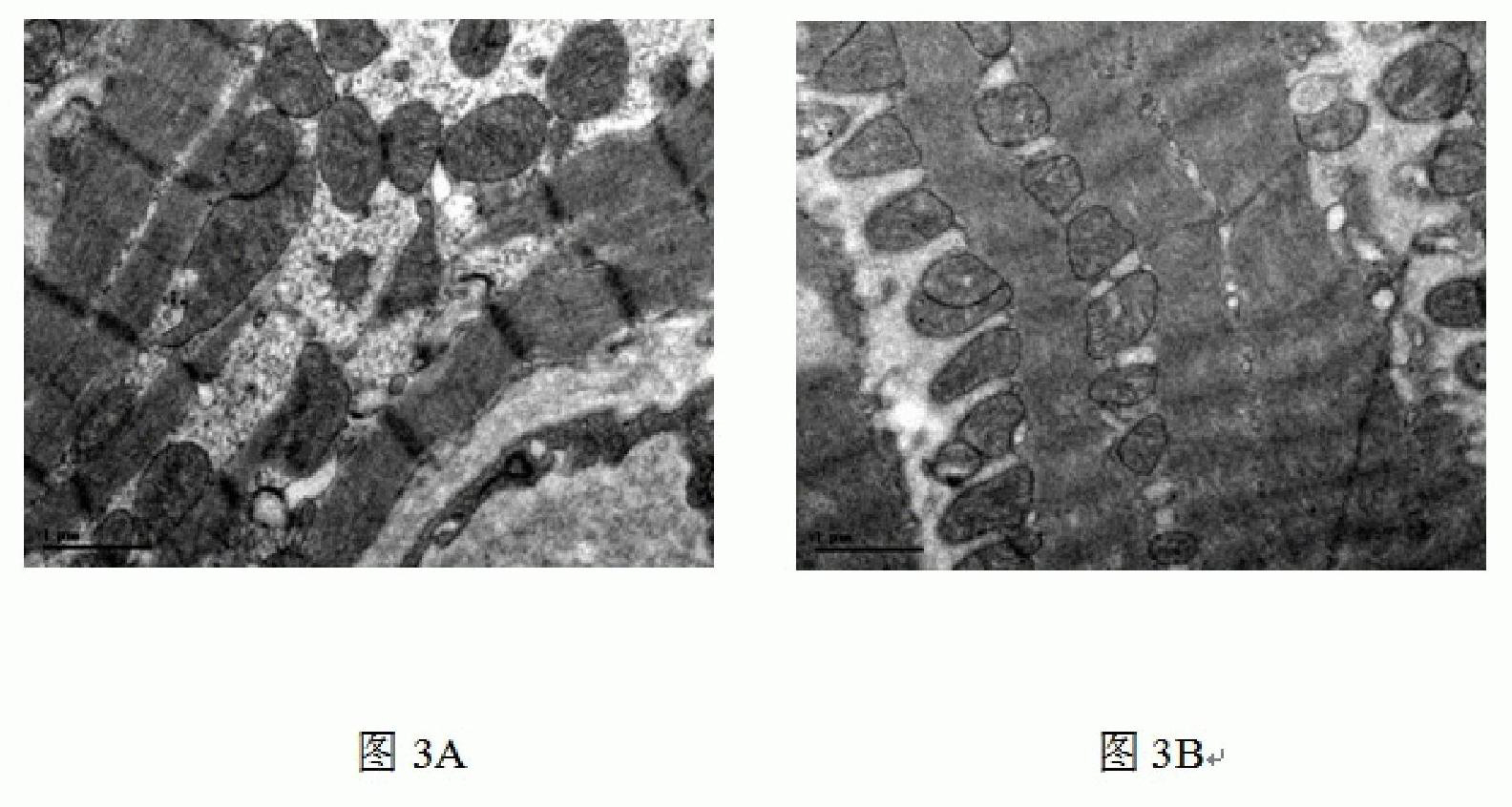 Method for preparing animal model with cardiac hypertrophy by unartificial ventilation