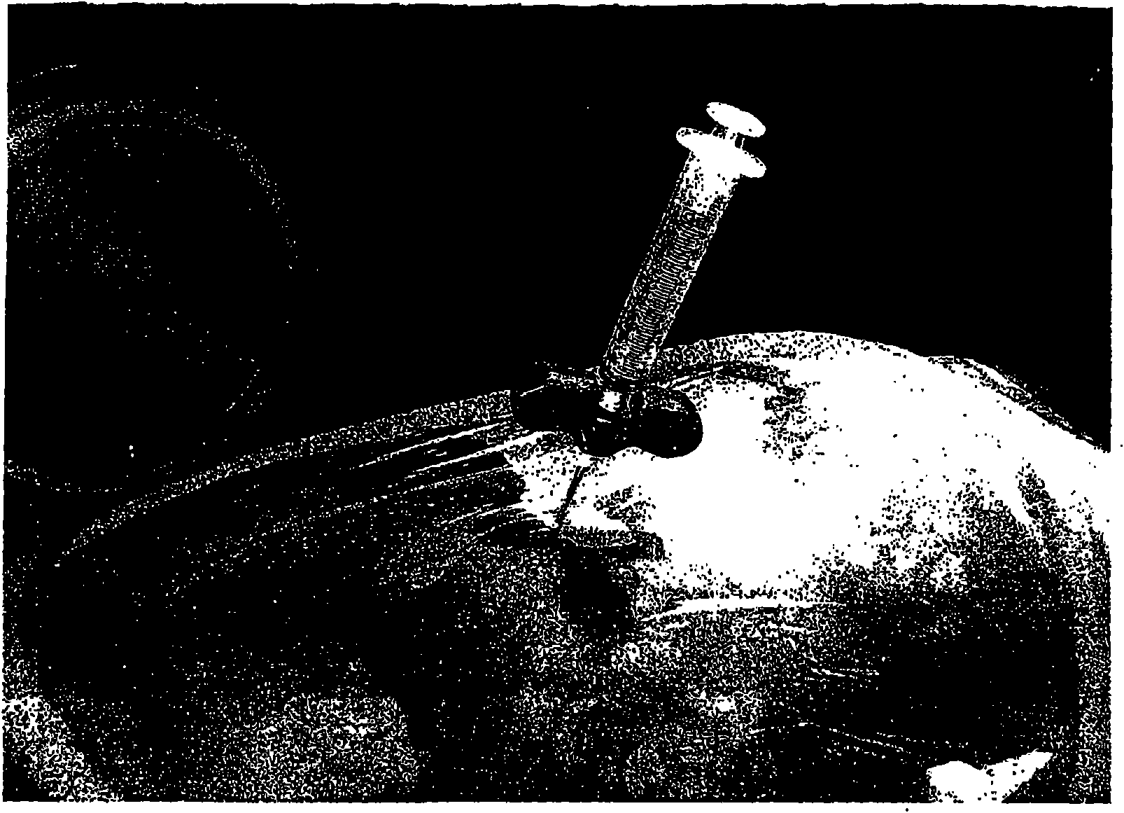 Compositions and methods for treating the vertebral column