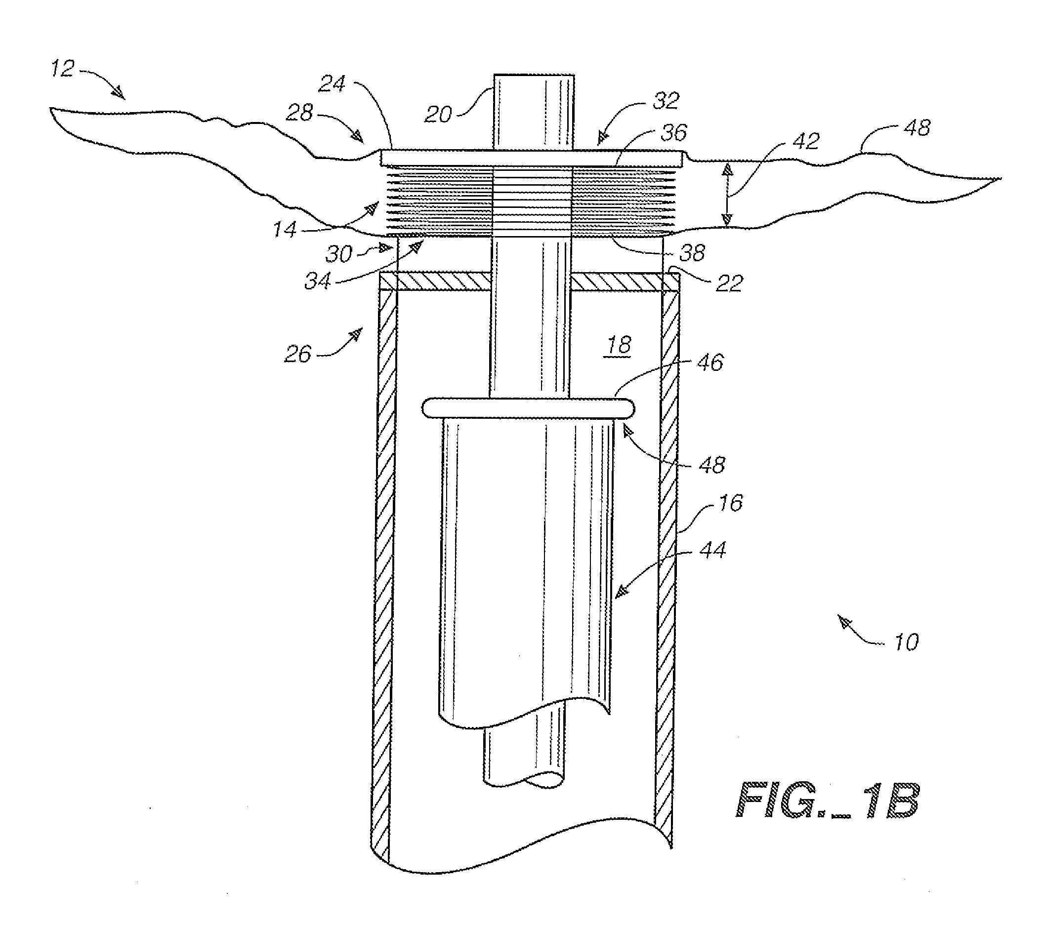 Aneurysm neck obstruction device