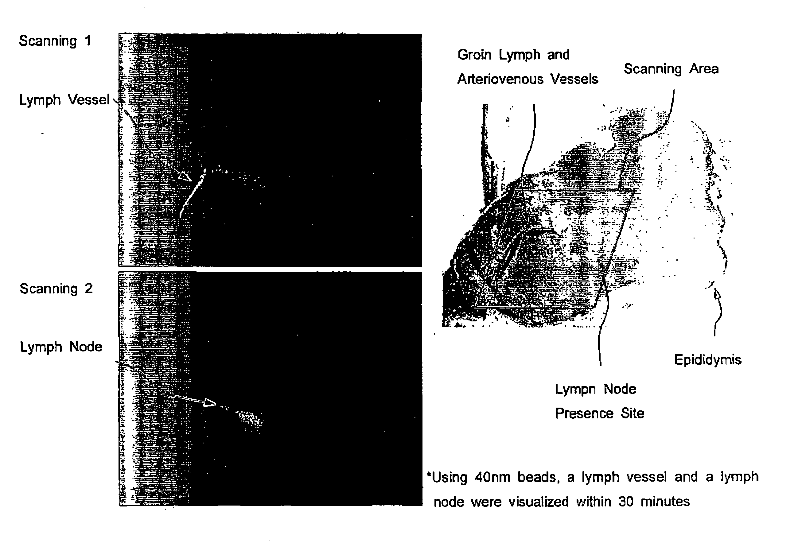 Agent for detecting sentinel lymph node and detection method