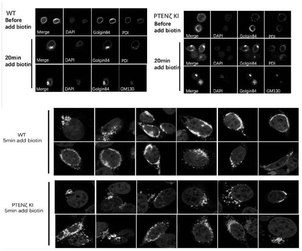 N-terminal extension type PTEN subtype PTEN zeta protein as well as coding gene and application thereof