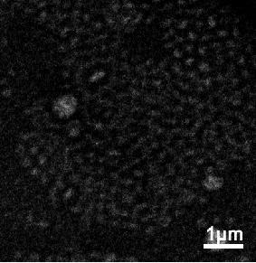 Pharmaceutical liposome containing Adriamycin and immunoadjuvant combination and preparation method for pharmaceutical liposome