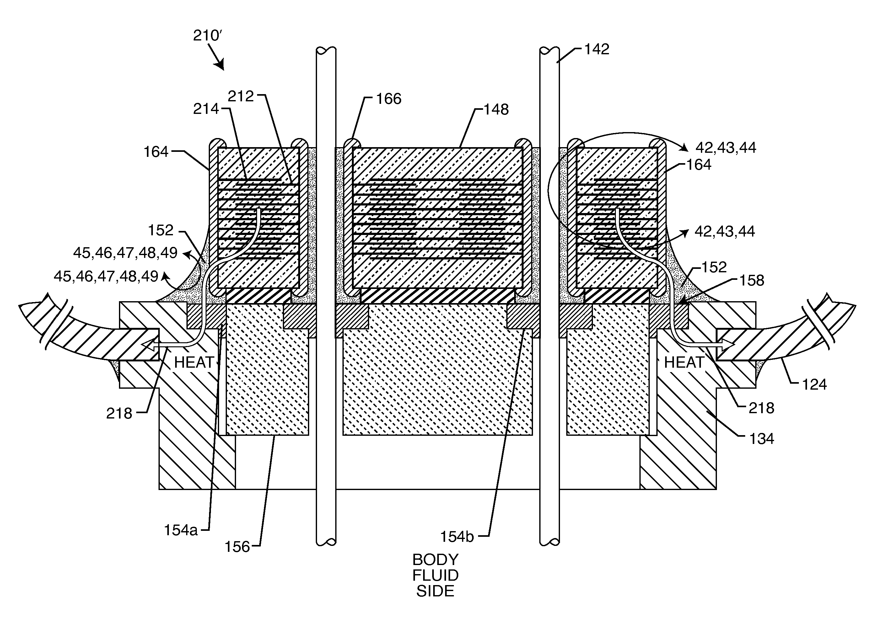 RF filter for an active medical device (AMD) for handling high RF power induced in an associated implanted lead from an external RF field