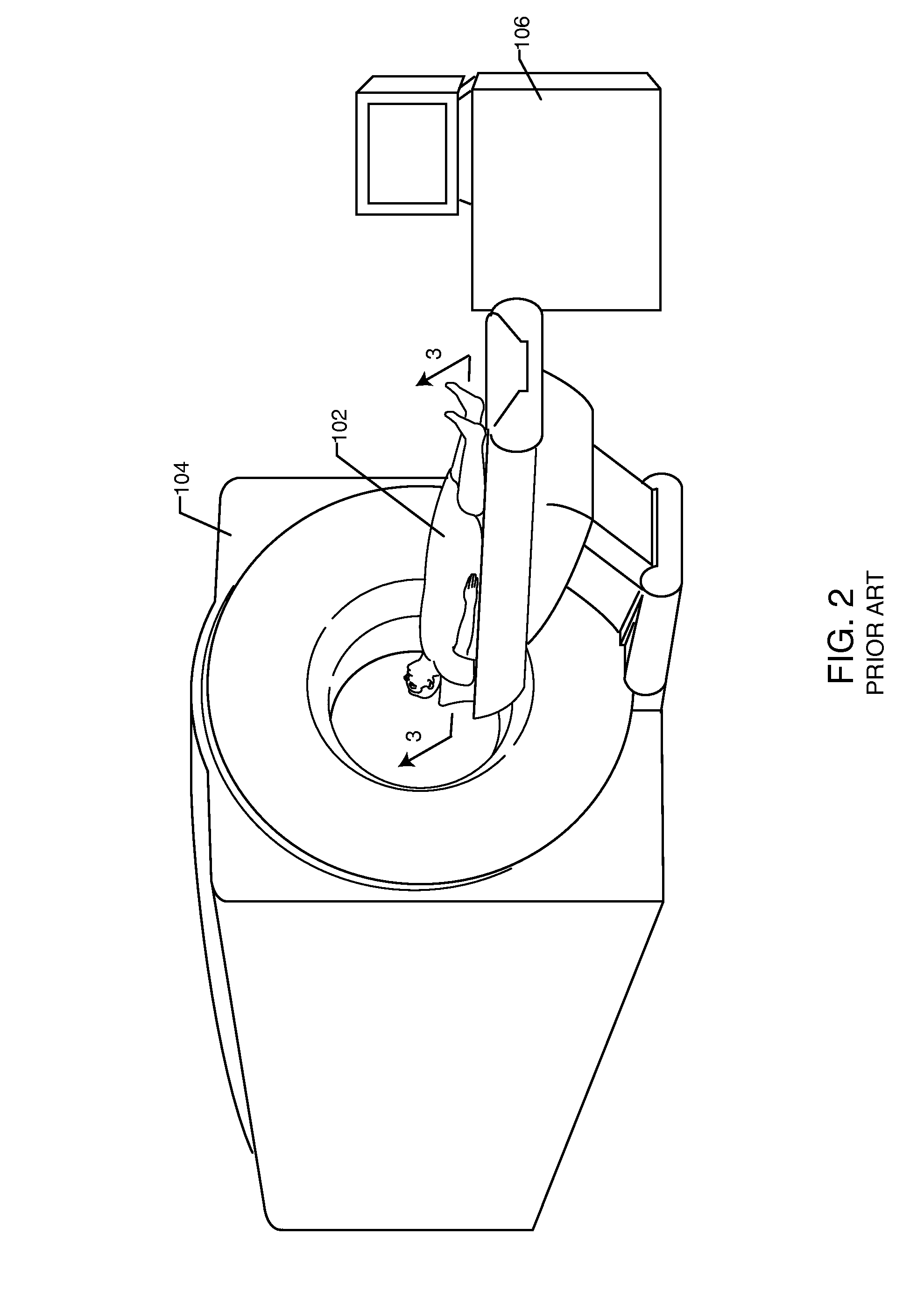 RF filter for an active medical device (AMD) for handling high RF power induced in an associated implanted lead from an external RF field