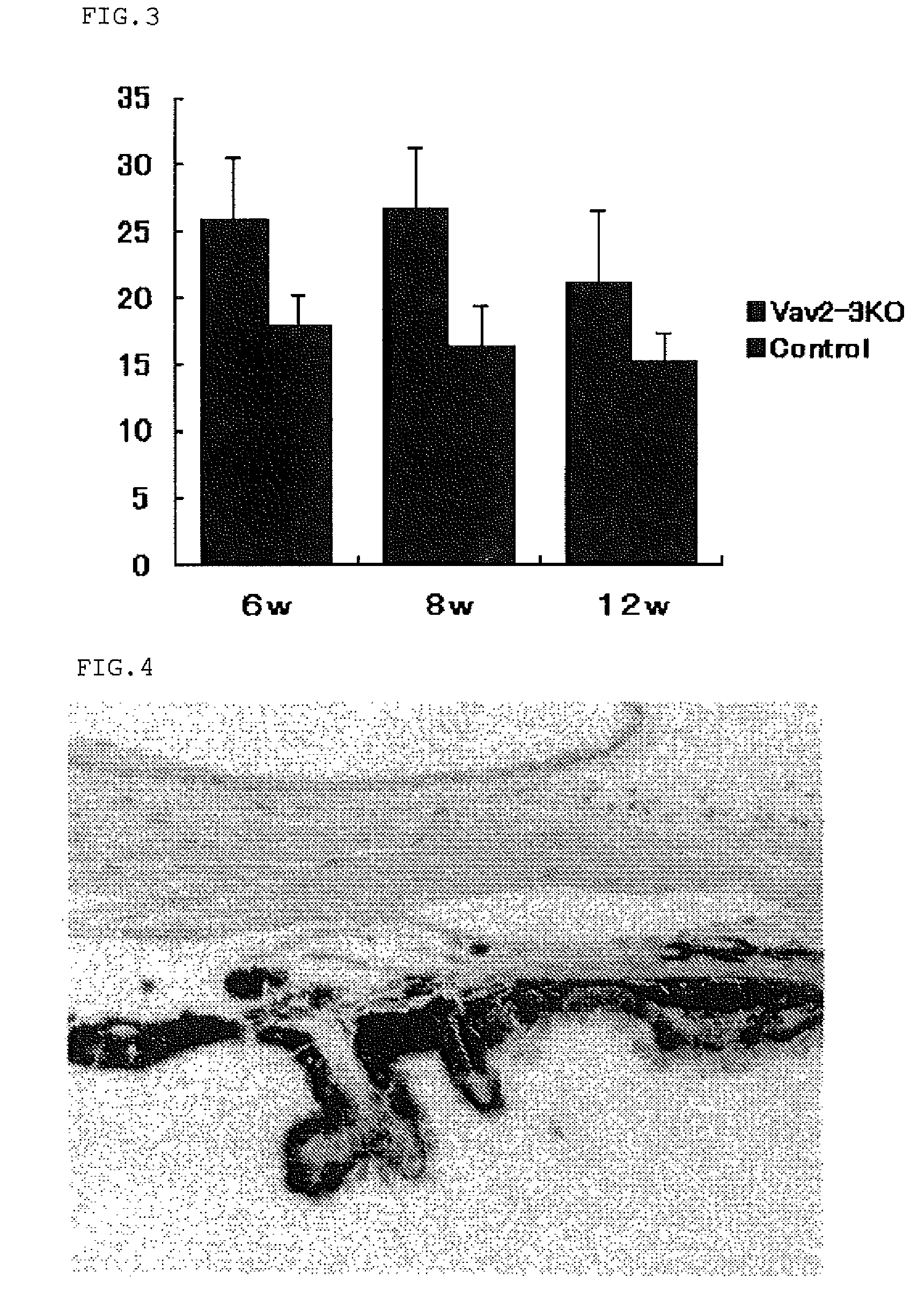 Mouse model for eye disease