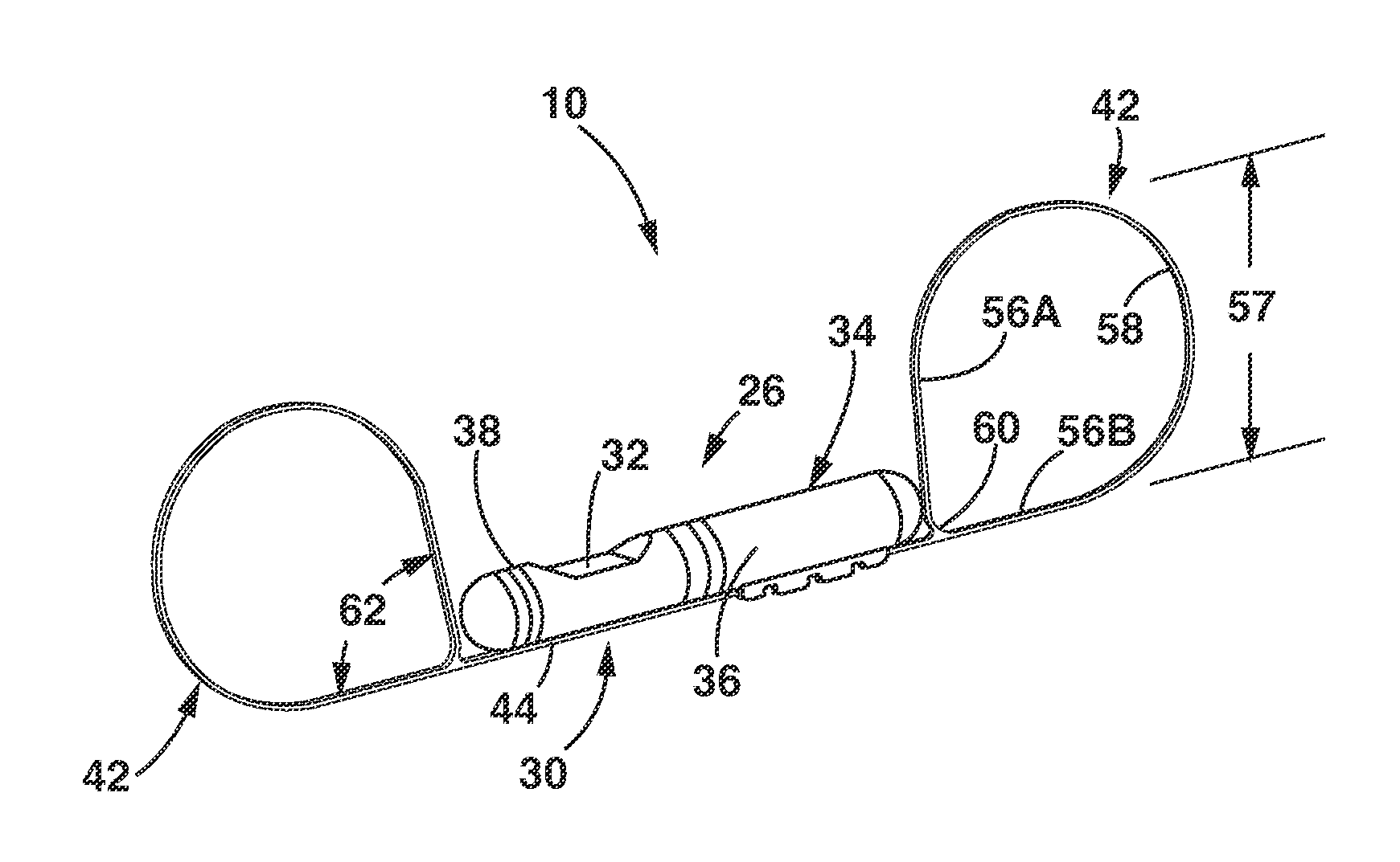 Implantable Medical Sensor and Fixation System