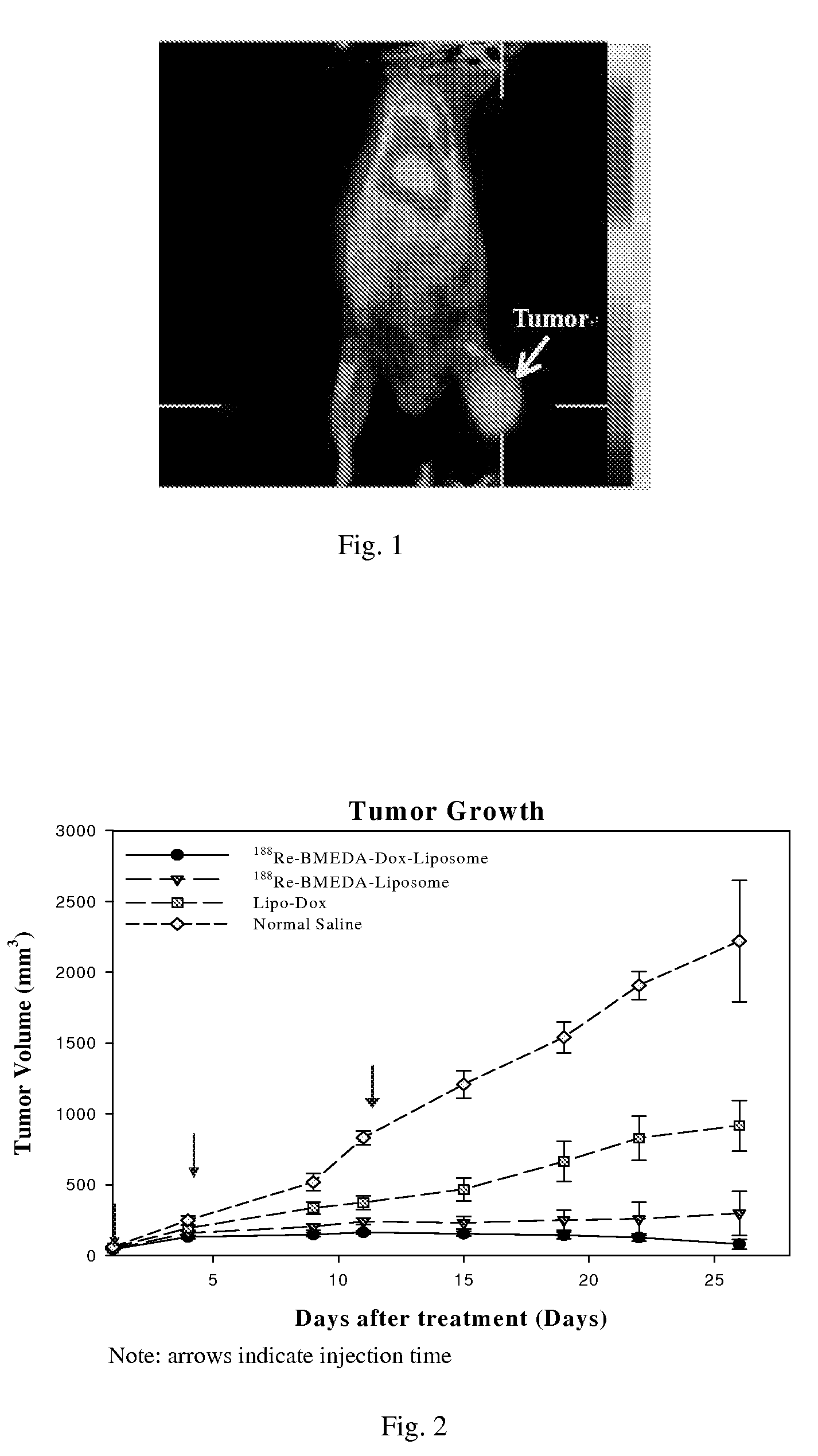 Kit for preparation of nano-targeted liposome drug in combined radionuclide therapy and chemotherapy