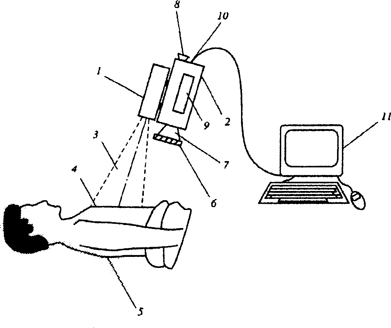 Locating and analyzing perforator flaps for plastic and reconstructive surgery