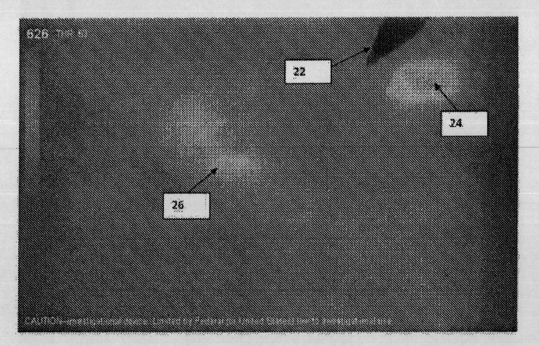 Locating and analyzing perforator flaps for plastic and reconstructive surgery